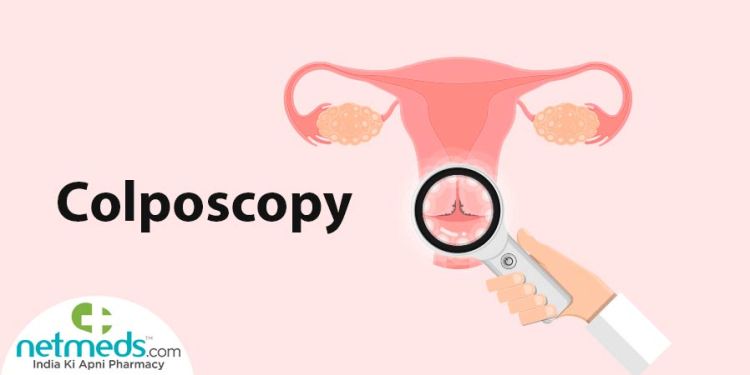 Colposcopy: Procedure, Risks And Results