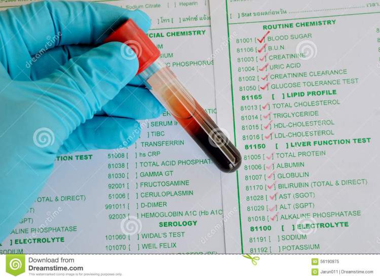 Blood chemistry testing stock image. Image of healthcare - 56190875