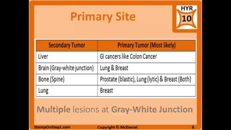 Metastasis, Cancer Nomenclature, Tumor Nomenclature Lymphatic Spread Metalloproteinase - YouTube