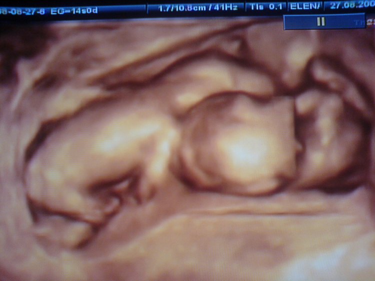 Archivo:TwinsMZ.JPG - Wikipedia, la enciclopedia libre