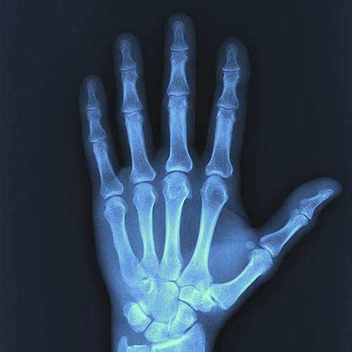 Digital X-ray Services in San Diego - Imaging Healthcare Specialists