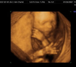 3d ultrasound images in New York, NY (Manhattan)