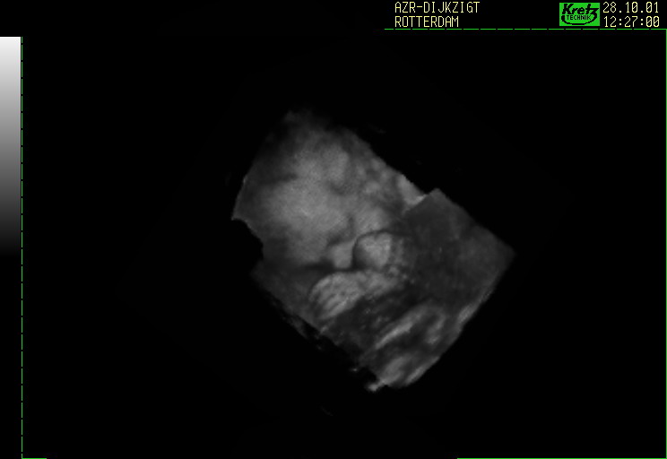 Fichier:3D Echo.jpg - Wikipédia