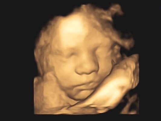 Packages - Kansas 4D Ultrasound