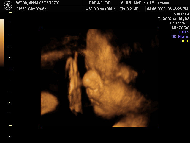 ultrasound-4d-baby1-20090406-16 - Hank Word - Flickr