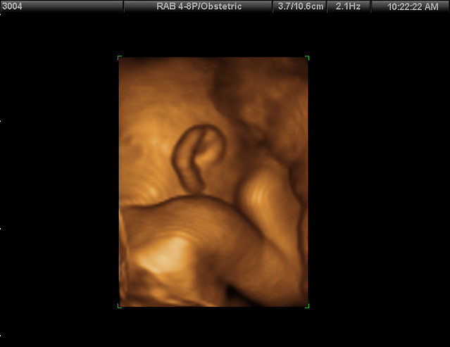 shoulder and an ear - Mrs. Flinger - Flickr