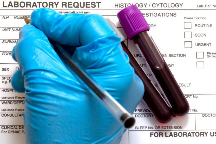 Differential blood test: Uses, procedure, and results
