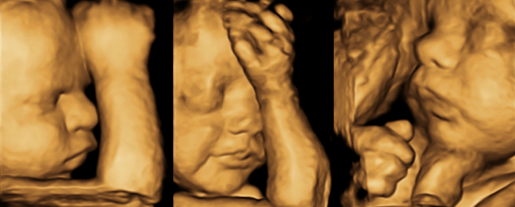 Living Images 3d 4d Ultrasound Studio Shalimar - Fort Walton Beach - Destin - Pensacola - Crestview