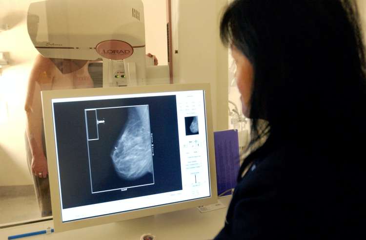 mammography