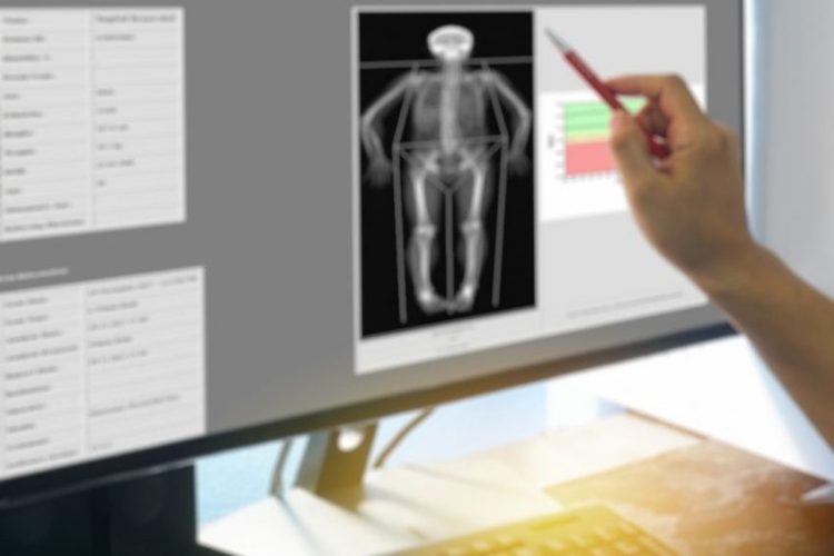 bone densitometry