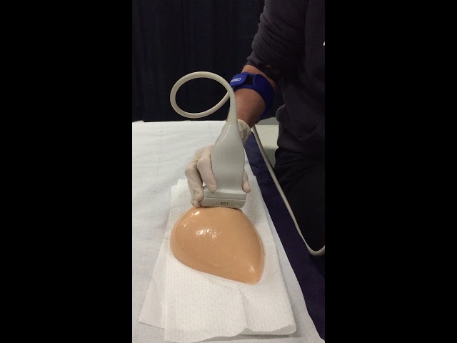 breast ultrasound